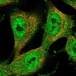 ZNF438 Antibody, Novus Biologicals 0.1mL; Unlabeled:Antibodies, Polyclonal